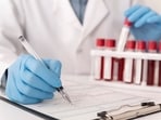 New approach that help overcome treatment resistance in cancer: Research