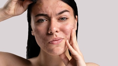 Myth: Shaving facial hair can cause acne and breakouts.Fact: Shaving facial hair can cause acne and breakouts if not done properly. It's important to use a clean razor and to shave in the direction of hair growth to avoid irritation and inflammation of the hair follicles. Exfoliating regularly can also help prevent ingrown hairs and breakouts. (File Photo) Myth: Shaving facial hair can cause acne and breakouts.Fact: Shaving facial hair can cause acne and breakouts if not done properly. It's important to use a clean razor and to shave in the direction of hair growth to avoid irritation and inflammation of the hair follicles. Exfoliating regularly can also help prevent ingrown hairs and breakouts. (File Photo)