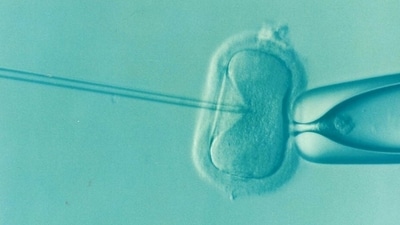 The New York Stem Cell Foundation Research Institute revealed a data which says approximately 1 in 5,000-10,000 children is born each year with mitochondrial disease. (Pixabay) The New York Stem Cell Foundation Research Institute revealed a data which says approximately 1 in 5,000-10,000 children is born each year with mitochondrial disease. (Pixabay)