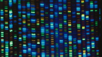 On Wednesday, May 10, 2023, scientists announced they have sequenced the genomes of 47 people from around the world, allowing scientists to be able to look at what's normal and what's not across people and learn more about what genes do and what diseases genetic problems may cause. (NHGRI via AP, File) (AP) On Wednesday, May 10, 2023, scientists announced they have sequenced the genomes of 47 people from around the world, allowing scientists to be able to look at what's normal and what's not across people and learn more about what genes do and what diseases genetic problems may cause. (NHGRI via AP, File) (AP)