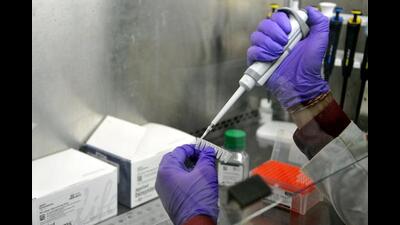 Dr Ashwani Kumar, additional director, CGHS, Chandigarh, ordered the de-empanelment of Dr Shamer Singh Memorial Radio Diagnostic Centre on May 1 due to expiration of NABH validity. (HT) Dr Ashwani Kumar, additional director, CGHS, Chandigarh, ordered the de-empanelment of Dr Shamer Singh Memorial Radio Diagnostic Centre on May 1 due to expiration of NABH validity. (HT)