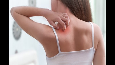 Owing to the onset of summer and soaring temperature, city-based doctors are seeing an increase in the number of skin related ailments (REPRESENTATIVE IMAGE) Owing to the onset of summer and soaring temperature, city-based doctors are seeing an increase in the number of skin related ailments (REPRESENTATIVE IMAGE)
