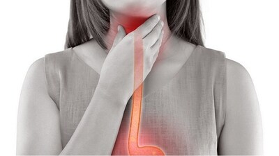 RNA molecules may aid in detection, treatment of esophageal cancer: Study (Pixabay) RNA molecules may aid in detection, treatment of esophageal cancer: Study (Pixabay)