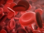 Hemophilia is rare but a serious disorder in men. Here are its types, signs, how it affects pregnancy, treatment 