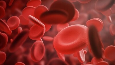Hemophilia is rare but a serious disorder in men. Here are its types, signs, how it affects pregnancy, treatment (Getty Images/iStockphoto) Hemophilia is rare but a serious disorder in men. Here are its types, signs, how it affects pregnancy, treatment (Getty Images/iStockphoto)