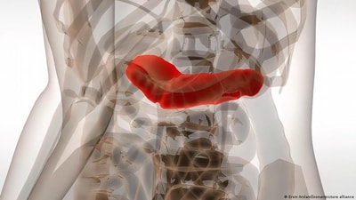 Pancreatic cancer is one of the deadliest cancers of all. A new mRNA vaccine could prevent tumors from returning. (Ersin Arslan/Zoonar/picture alliance) Pancreatic cancer is one of the deadliest cancers of all. A new mRNA vaccine could prevent tumors from returning. (Ersin Arslan/Zoonar/picture alliance)