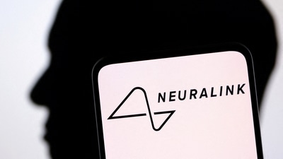 The aim of Neuralink implants is to enable human brains to communicate directly with computers. (Reuters)