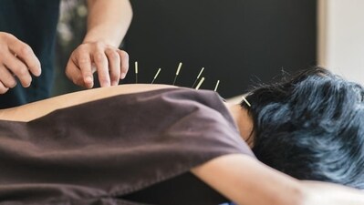 Acupuncture: It may play a crucial role in relaxing the nervous system and aid with cramp relief. This traditional Asian medicinal technique is supposed to calm the nervous system, increase blood flow to internal organs, and reduce inflammation. (Shutterstock) Acupuncture: It may play a crucial role in relaxing the nervous system and aid with cramp relief. This traditional Asian medicinal technique is supposed to calm the nervous system, increase blood flow to internal organs, and reduce inflammation. (Shutterstock)