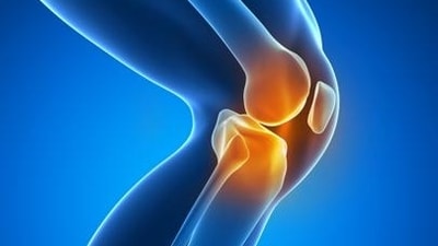 Intravenous, periarticular corticosteroids improve recovery after knee surgery (Shutterstock) Intravenous, periarticular corticosteroids improve recovery after knee surgery (Shutterstock)