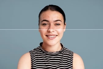 Melasma, a prevalent skin condition, manifests as dark patches on the face and can significantly impact one's self-esteem. (Freepik ) Melasma, a prevalent skin condition, manifests as dark patches on the face and can significantly impact one's self-esteem. (Freepik )