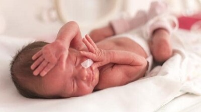 Premature, low birthweight newborns suffer fewer fractures than others: Study Premature, low birthweight newborns suffer fewer fractures than others: Study