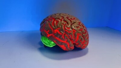 World Brain Tumour Day plays a vital role in addressing the global burden of brain tumors and striving for better outcomes for patients worldwide. (Unsplash) World Brain Tumour Day plays a vital role in addressing the global burden of brain tumors and striving for better outcomes for patients worldwide. (Unsplash)
