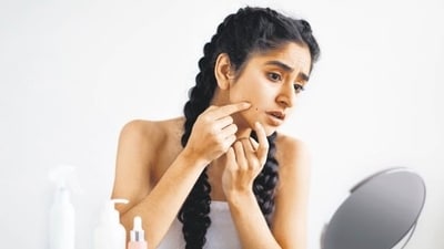For acne and breakouts, Hormonal fluctuations, pollution, diet, lifestyle or simply genetics are the usual culprits. (Shutterstock) For acne and breakouts, Hormonal fluctuations, pollution, diet, lifestyle or simply genetics are the usual culprits. (Shutterstock)