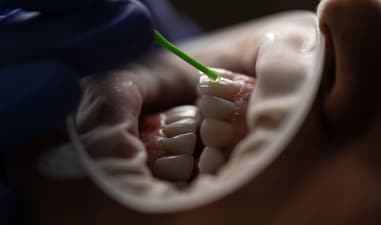Say goodbye to tobacco stains: Expert tips on restoring your smile (Photo by Kamal Hoseinianzade on Unsplash) Say goodbye to tobacco stains: Expert tips on restoring your smile (Photo by Kamal Hoseinianzade on Unsplash)