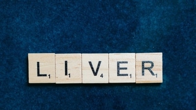 The percentage of adults with metabolic-associated fatty liver disease (MAFLD), the major global cause of liver disease, is growing. (Pexels) The percentage of adults with metabolic-associated fatty liver disease (MAFLD), the major global cause of liver disease, is growing. (Pexels)