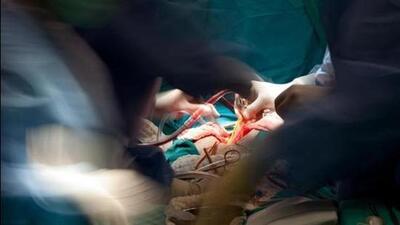 During the past two years, out of the 201 referred children, 63 have already undergone surgeries, while the remaining children are either receiving medical treatment or waiting for their scheduled surgeries. (HT Files) During the past two years, out of the 201 referred children, 63 have already undergone surgeries, while the remaining children are either receiving medical treatment or waiting for their scheduled surgeries. (HT Files)