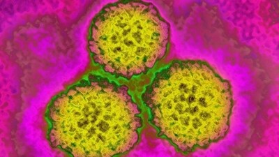 HPV stands for human papillomavirus. There are over 100 different types of HPV. (Cavallini/BSIP/picture alliance) HPV stands for human papillomavirus. There are over 100 different types of HPV. (Cavallini/BSIP/picture alliance)