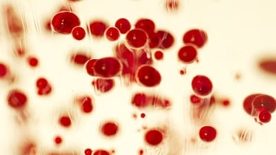 World Sickle Cell Awareness Day: The day is observed to make people make more aware about sickle cell disease and the challenges that are experienced by patients, their families and their caregivers. (Freepik) World Sickle Cell Awareness Day: The day is observed to make people make more aware about sickle cell disease and the challenges that are experienced by patients, their families and their caregivers. (Freepik)