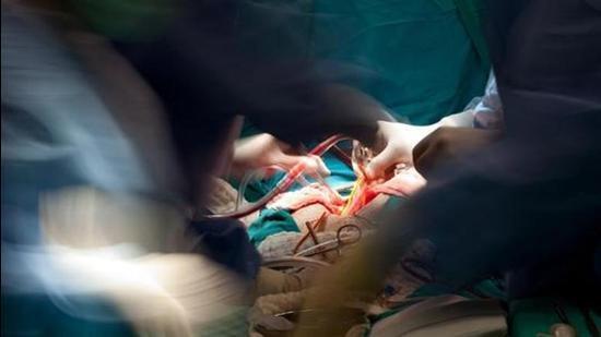 During the past two years, out of the 201 referred children, 63 have already undergone surgeries, while the remaining children are either receiving medical treatment or waiting for their scheduled surgeries. (HT Files)