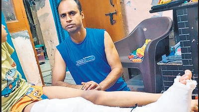 Sahil Singh’s son, 8, suffered a fracture in his leg. (HT Photo) Sahil Singh’s son, 8, suffered a fracture in his leg. (HT Photo)