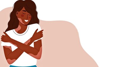 The emotional toll of living with this condition can be significant, leading to feelings of insecurity and isolation. (Shutterstock) The emotional toll of living with this condition can be significant, leading to feelings of insecurity and isolation. (Shutterstock)