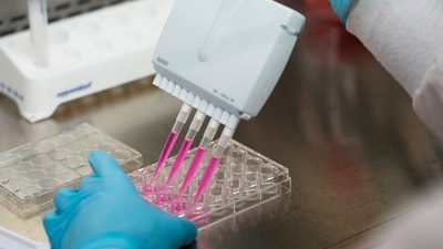 Research scientist Kevin Potts uses a multichannel pipette to dissociate ovarian cancer cells with the enzyme trypsin at UW Medicine's Cancer Vaccine Institute, May 25, in Seattle. (AP) Research scientist Kevin Potts uses a multichannel pipette to dissociate ovarian cancer cells with the enzyme trypsin at UW Medicine's Cancer Vaccine Institute, May 25, in Seattle. (AP)