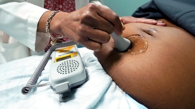 A doctor uses a hand-held Doppler probe on a pregnant woman to measure the heartbeat of tThe baby would require neonatal care, as per the doctors. (Representative) (AP) A doctor uses a hand-held Doppler probe on a pregnant woman to measure the heartbeat of tThe baby would require neonatal care, as per the doctors. (Representative) (AP)