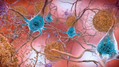 Neurons linked to chronic stress: Research (AP)
