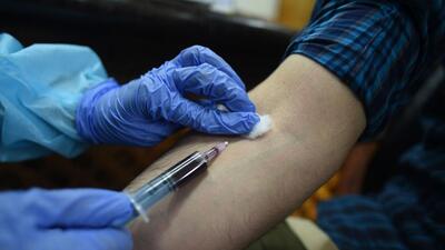 The reports of blood samples of patients taken by the health department are still awaited. (HT FIle Photo) The reports of blood samples of patients taken by the health department are still awaited. (HT FIle Photo)