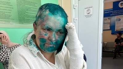 Russian investigative journalist Elena Milashina speaking on a mobile phone at a hospital in the Chechen capital Grozny. (AFP) Russian investigative journalist Elena Milashina speaking on a mobile phone at a hospital in the Chechen capital Grozny. (AFP)