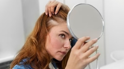 "Premature graying of hair in youngsters is on the rise. While stress and lifestyle is a lead factor, diet and nutrition also plays a major role. The advent of fast food and instant meals is leaching our meals of essential nutrients and it’s time to bring black back!" says Nutritionist Nmami Agarwal. (Freepik) "Premature graying of hair in youngsters is on the rise. While stress and lifestyle is a lead factor, diet and nutrition also plays a major role. The advent of fast food and instant meals is leaching our meals of essential nutrients and it’s time to bring black back!" says Nutritionist Nmami Agarwal. (Freepik)