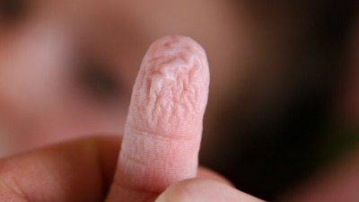 A baby's wrinkled finger after a warm bath (Pixabay/Fir0002/Flagstaffotos) A baby's wrinkled finger after a warm bath (Pixabay/Fir0002/Flagstaffotos)