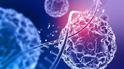 Exposure to chemicals, viruses, chronic swelling, radiation therapy, and other inherited syndromes are risk factors for sarcoma. (Freepik) Exposure to chemicals, viruses, chronic swelling, radiation therapy, and other inherited syndromes are risk factors for sarcoma. (Freepik)