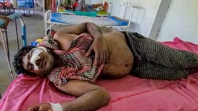 An injured being treated at a local hospital after clashes between rival political groups during panchayat elections, in Hooghly district of West Bengal on Saturday, (PTI) An injured being treated at a local hospital after clashes between rival political groups during panchayat elections, in Hooghly district of West Bengal on Saturday, (PTI)