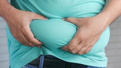By 2020, 40 per cent of the population in the United States will be obese, making it a growing public health problem. (Photo by Towfiqu barbhuiya on Unsplash) By 2020, 40 per cent of the population in the United States will be obese, making it a growing public health problem. (Photo by Towfiqu barbhuiya on Unsplash)