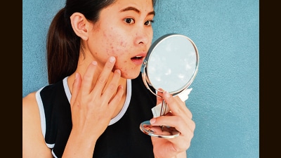 What we eat impacts our skin health too. says experts. What we eat impacts our skin health too. says experts.
