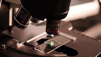 Type 1 diabetes occurs when the immune system destroys the insulin-producing “islet cells” of the pancreas. (ANI) Type 1 diabetes occurs when the immune system destroys the insulin-producing “islet cells” of the pancreas. (ANI)