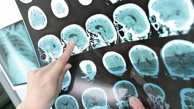 The also study said patients should not panic or lose faith in the health care system. (Shutterstock) The also study said patients should not panic or lose faith in the health care system. (Shutterstock)