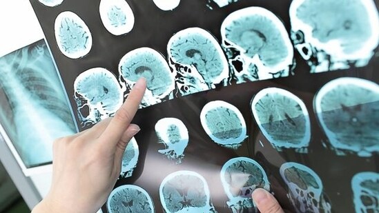 The also study said patients should not panic or lose faith in the health care system.(Shutterstock)