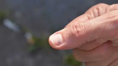 Abnormal nail shapes can show chronic iron deficiency anemia. They can also be a symptom of respiratory or heart diseases. (Unsplash) Abnormal nail shapes can show chronic iron deficiency anemia. They can also be a symptom of respiratory or heart diseases. (Unsplash)