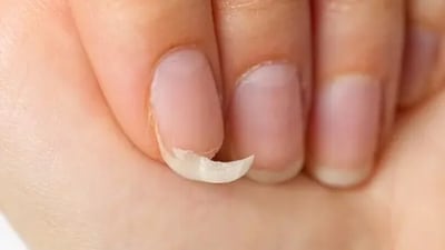 Brittleness in nails is often complained about, by women. This can be due to under-active thyroid. (Unsplash) Brittleness in nails is often complained about, by women. This can be due to under-active thyroid. (Unsplash)