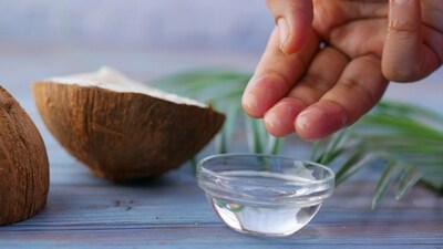 Coconut oil stops the bleeding, speeds up the healing process and protects the wound from dirt and dust. Coconut oil has anti-microbial and anti-fungal properties that protect wounds from infection. (pexels)