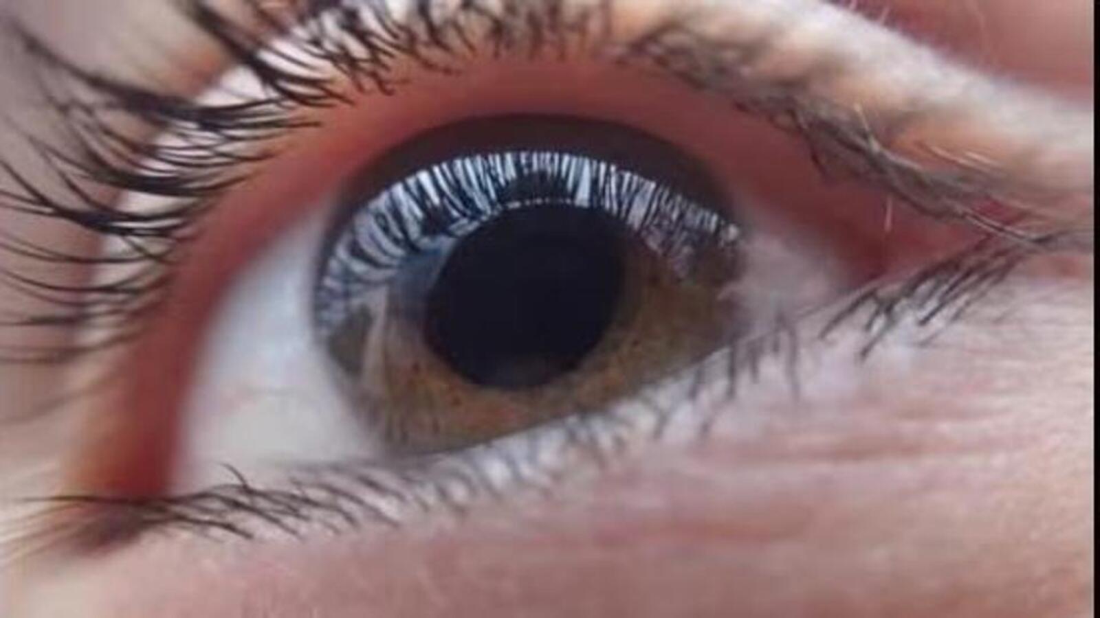 Udhampur's Northern Command Hospital conducts its first corneal transplant surgery - Vimarsana News