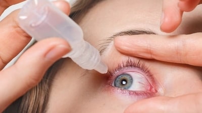 Conjunctivitis is a common eye infection that causes inflammation of the conjunctiva, the thin, transparent layer that covers the white part of the eye and lines the inner surface of the eyelids. (Freepik) Conjunctivitis is a common eye infection that causes inflammation of the conjunctiva, the thin, transparent layer that covers the white part of the eye and lines the inner surface of the eyelids. (Freepik)