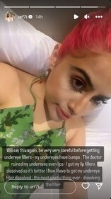 Uorfi posted a selfie as she made a face. Uorfi posted a selfie as she made a face.