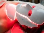 Red light therapy, the TikTok trend dermatologists approve. Red light therapy, the TikTok trend dermatologists approve.