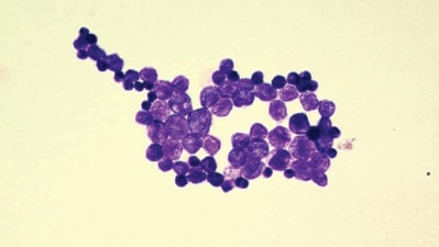 Prototheca appears to have developed a mechanism to elude detection by the immune system. (CDC) Prototheca appears to have developed a mechanism to elude detection by the immune system. (CDC)