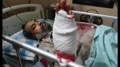 A Punjab head constable, Kikkar Singh, suffered a severe hand injury after a group of five snatchers attacked him near Dhunike village in Bathinda on Wednesday