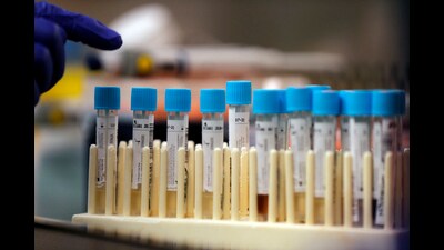 Data of close to 200 patients being treated for infections caused by carbapenem-resistant organisms across six hospitals in the country will be analysed during the course of the study. Carbapenem is a class of antibiotics usually reserved for known or suspected multidrug-resistant bacterial infections. (File photo for representation) Data of close to 200 patients being treated for infections caused by carbapenem-resistant organisms across six hospitals in the country will be analysed during the course of the study. Carbapenem is a class of antibiotics usually reserved for known or suspected multidrug-resistant bacterial infections. (File photo for representation)