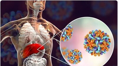People with hepatitis C cure still face risk of death: Study (Twitter/Journalofclin12) People with hepatitis C cure still face risk of death: Study (Twitter/Journalofclin12)